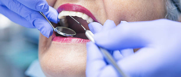 Best Emergency Dental Care for Abscessed Tooth in Bellville, OH